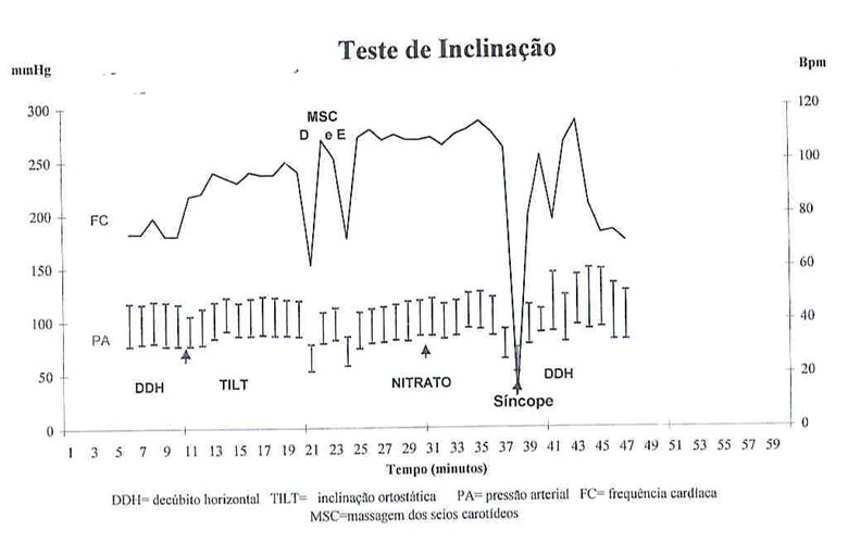 SciELO - Brasil - Teste de inclinação (Tilt-test): do necessário ao  imprescindível Teste de inclinação (Tilt-test): do necessário ao  imprescindível